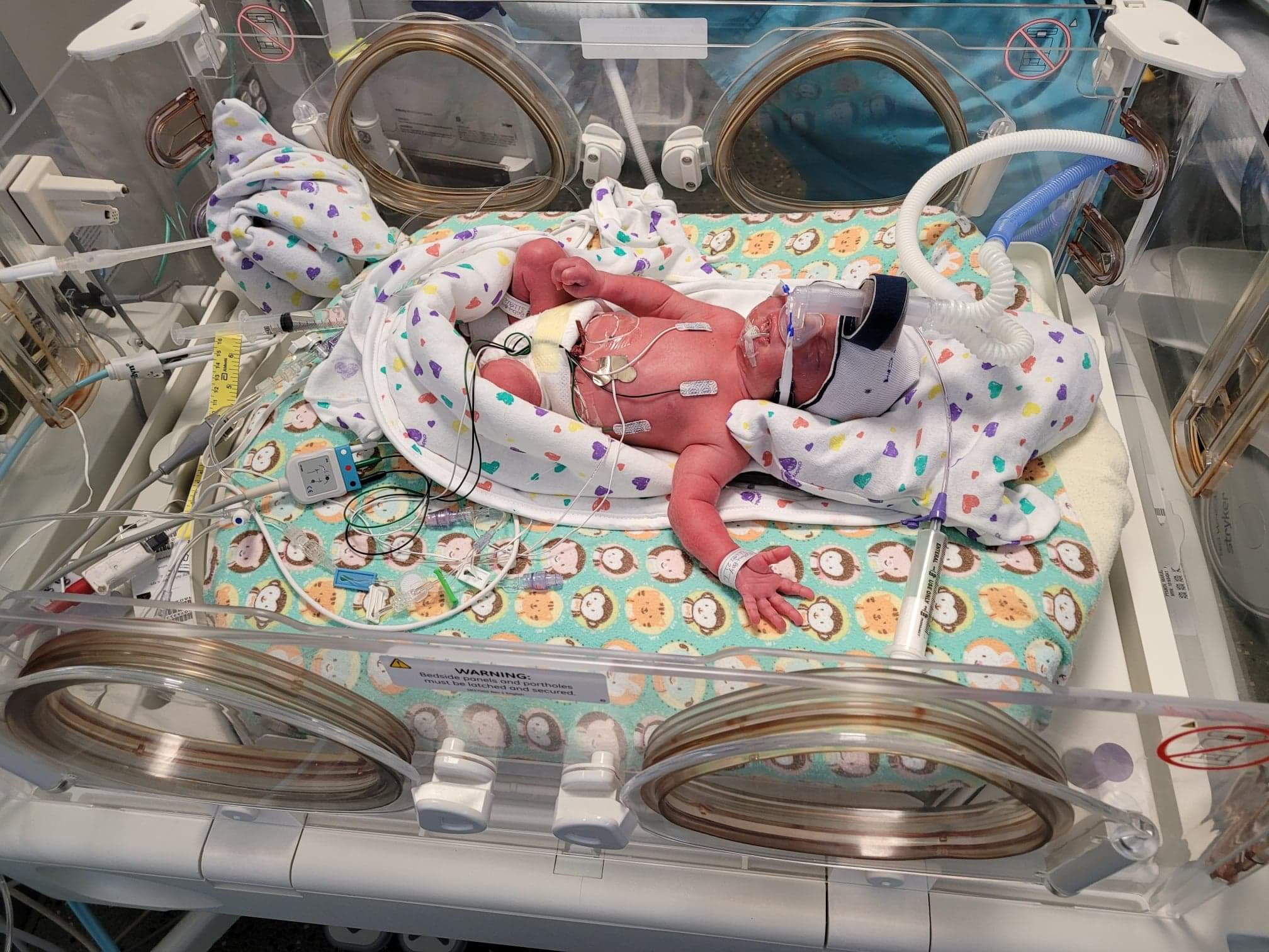 Read more about the article Premature Babies – What to Expect in The NICU